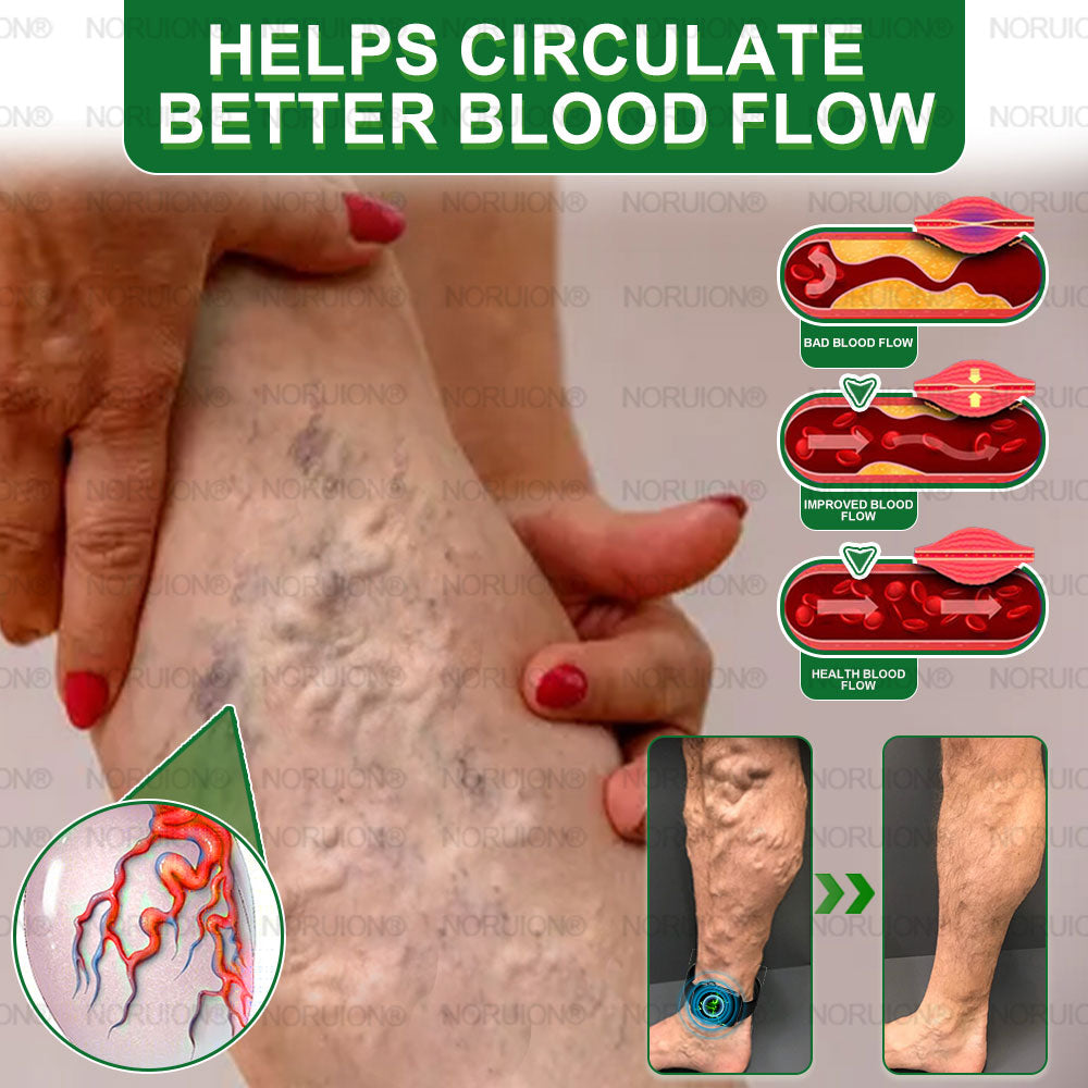 NORUION® Ultrasound Fat-Breaking & Far-Infrared Blood Sugar Balancing Detox Watch 【FDA Approved & Suitable for everyone】