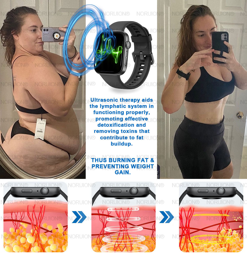 NORUION® Ultrasound Fat-Breaking & Far-Infrared Blood Sugar Balancing Detox Watch 【FDA Approved & Suitable for everyone】