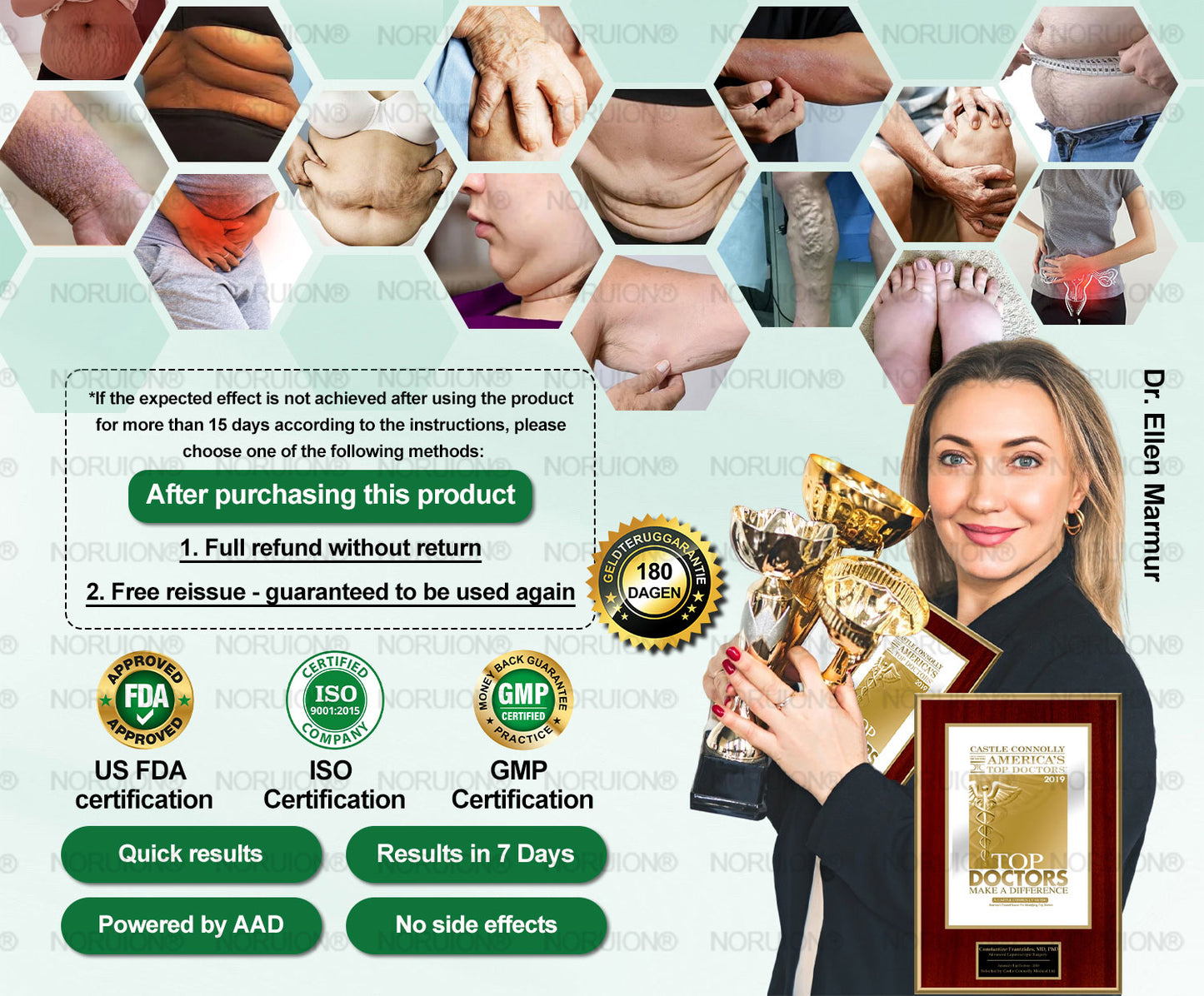 NORUION® Ultrasound Fat-Breaking & Far-Infrared Blood Sugar Balancing Detox Watch 【FDA Approved & Suitable for everyone】