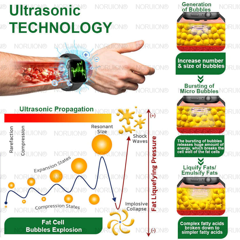 NORUION® Ultrasound Fat-Breaking & Far-Infrared Blood Sugar Balancing Detox Watch 【FDA Approved & Suitable for everyone】