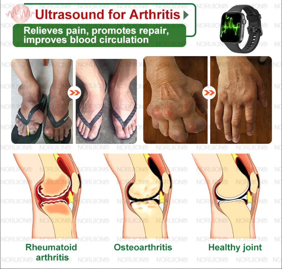 NORUION® Ultrasound Fat-Breaking & Far-Infrared Blood Sugar Balancing Detox Watch 【FDA Approved & Suitable for everyone】